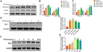 Inhibition of Sirt2 Alleviates Fibroblasts Activation and Pulmonary Fibrosis via Smad2/3 Pathway